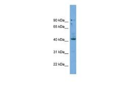 Hoxb3 Rabbit anti-Human, Polyclonal, Novus Biologicals:Antibodies:Primary